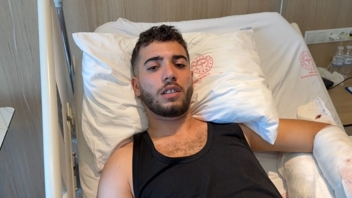 ankarada calistigi is yerindeki kopegin saldirisina ugrayan adam yaralandi SONfFv1N.jpg